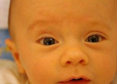 آیا ترنجبین در درمان زردی نوزاد موثر است؟